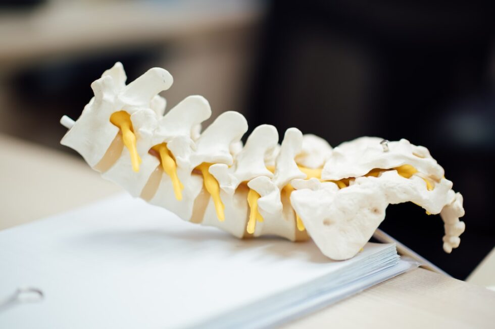 what-is-a-chance-fracture-of-the-spine-my-online-chiropractor